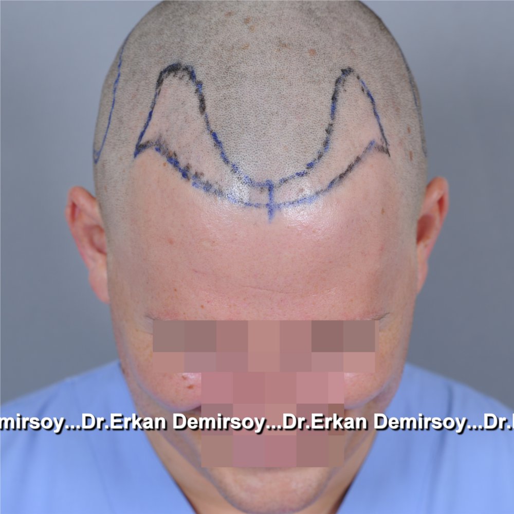 index.php/fa/18835/0/