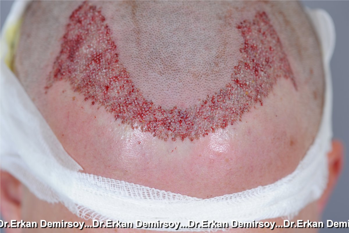 index.php/fa/18836/0/