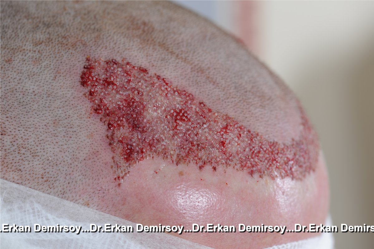 index.php/fa/18837/0/