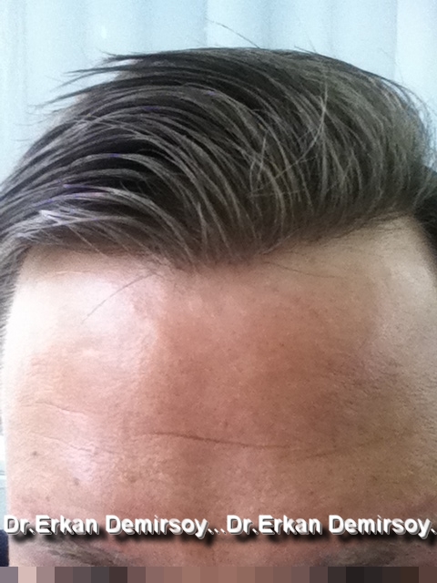 index.php/fa/18839/0/