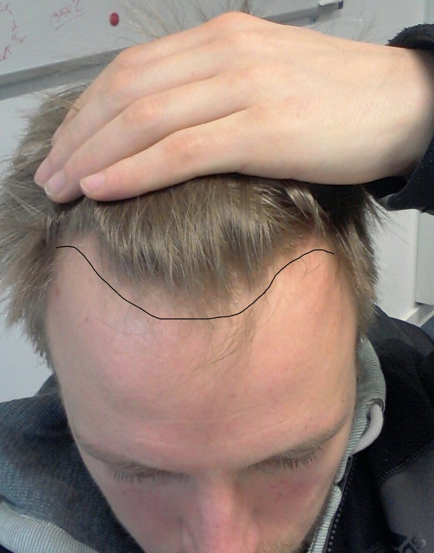 index.php/fa/18887/0/