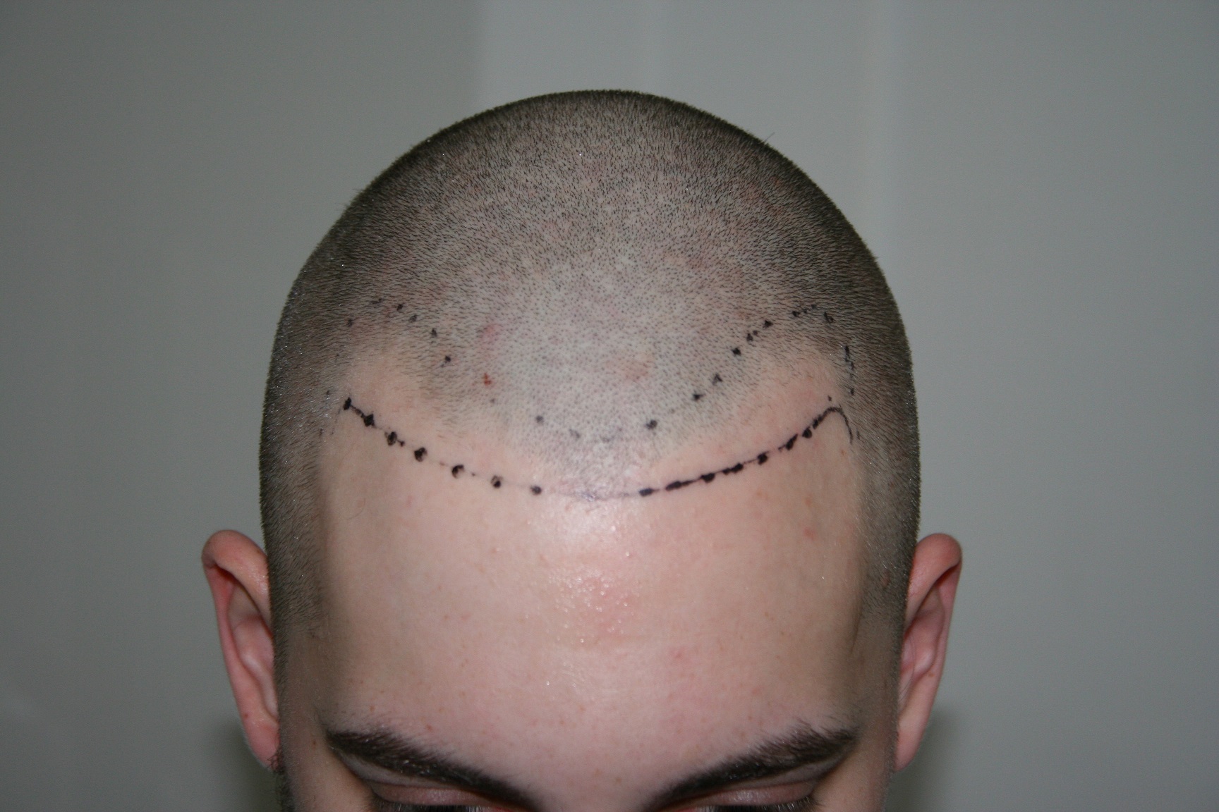 index.php/fa/18938/0/