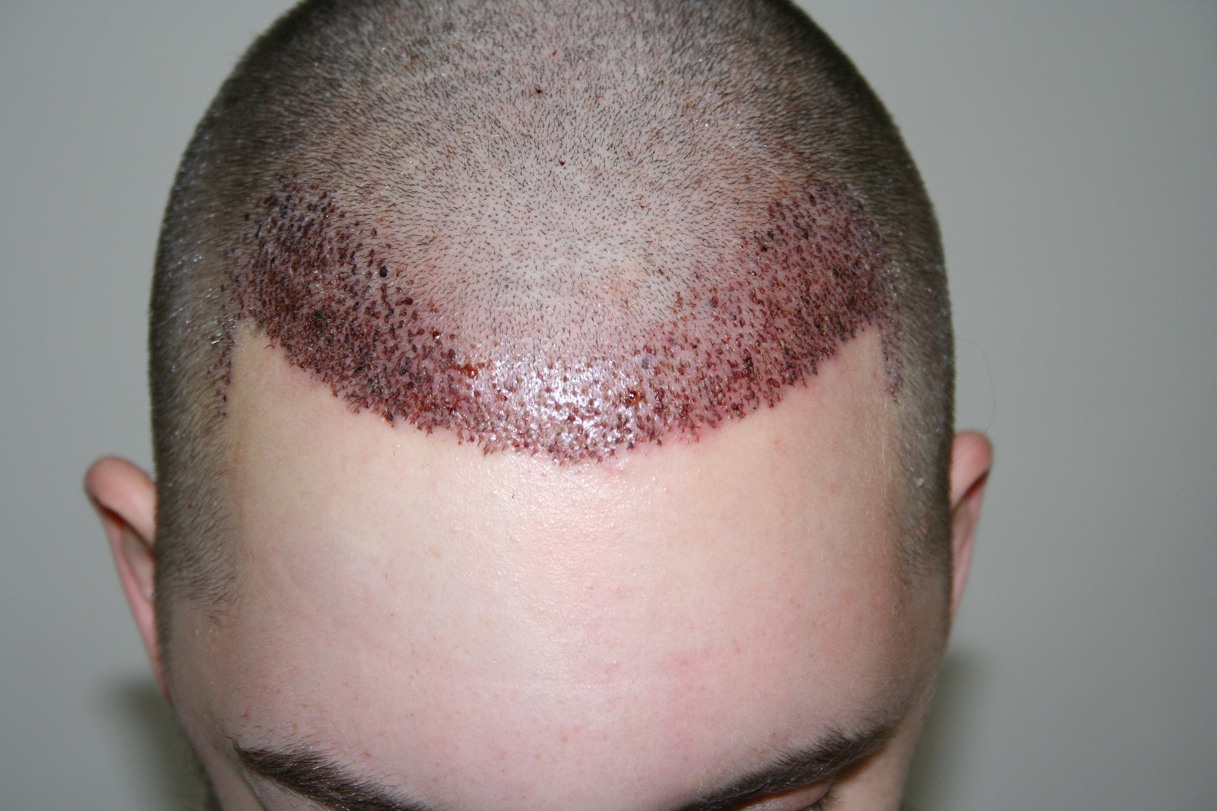 index.php/fa/18939/0/