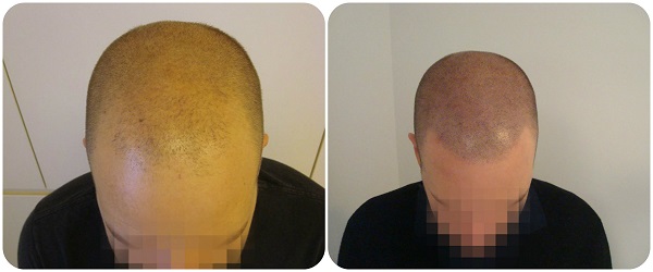 index.php/fa/18943/0/