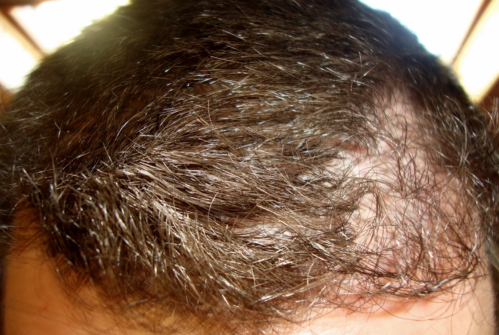 index.php/fa/19080/0/