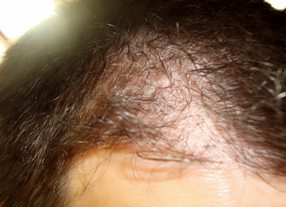 index.php/fa/19081/0/