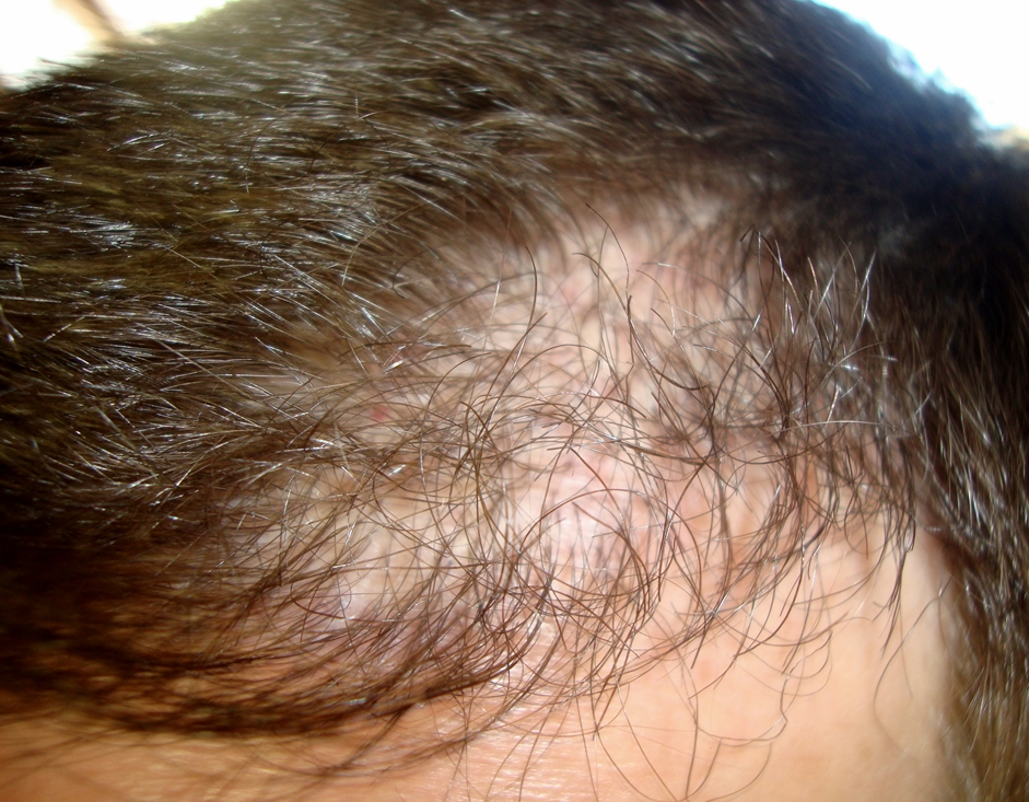 index.php/fa/19082/0/