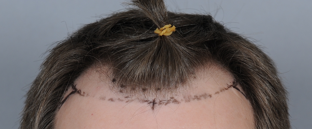 index.php/fa/19083/0/