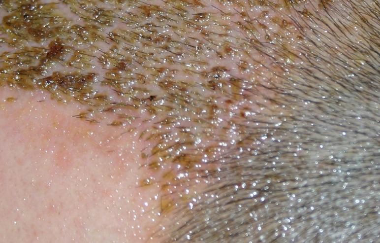 index.php/fa/1910/0/