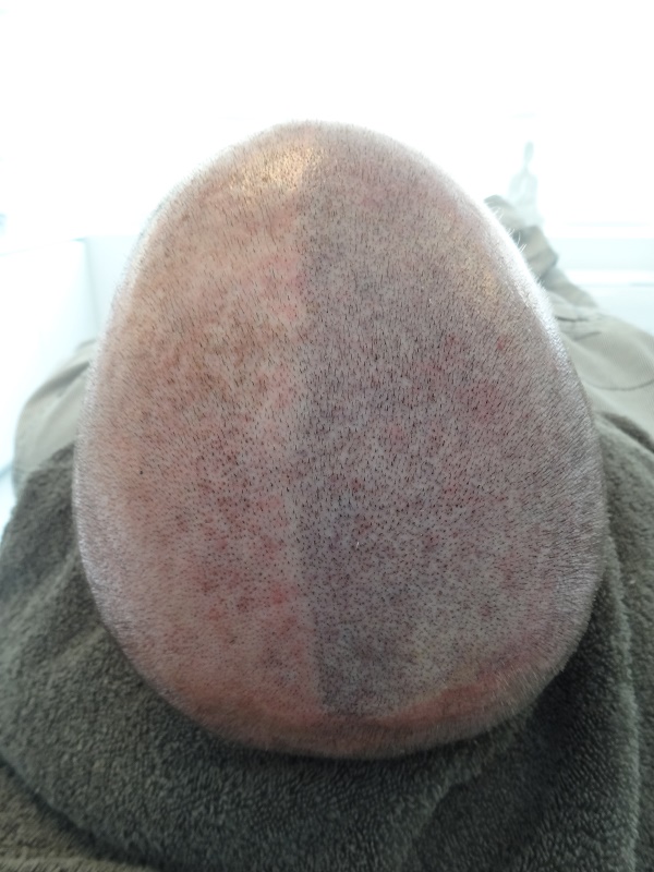 index.php/fa/19125/0/