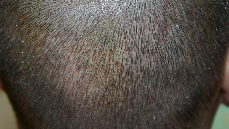 index.php/fa/1913/0/