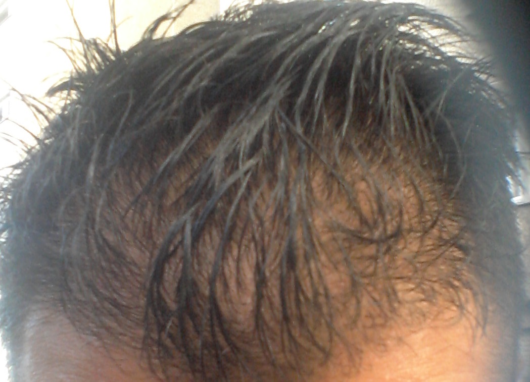 index.php/fa/19488/0/