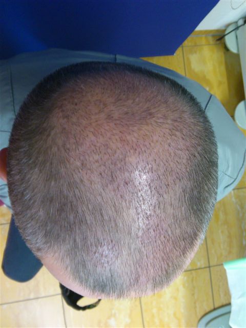 index.php/fa/19607/0/