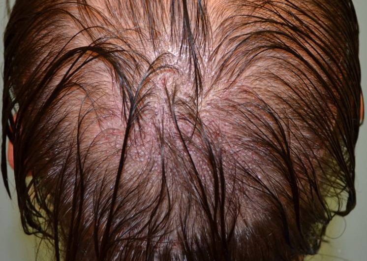 index.php/fa/19974/0/