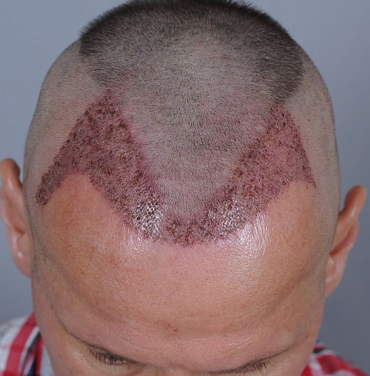 index.php/fa/19977/0/