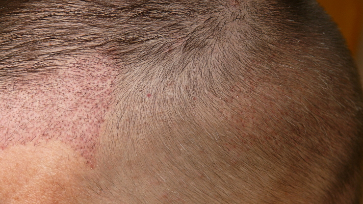 index.php/fa/19978/0/