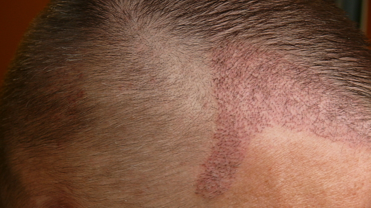 index.php/fa/19979/0/