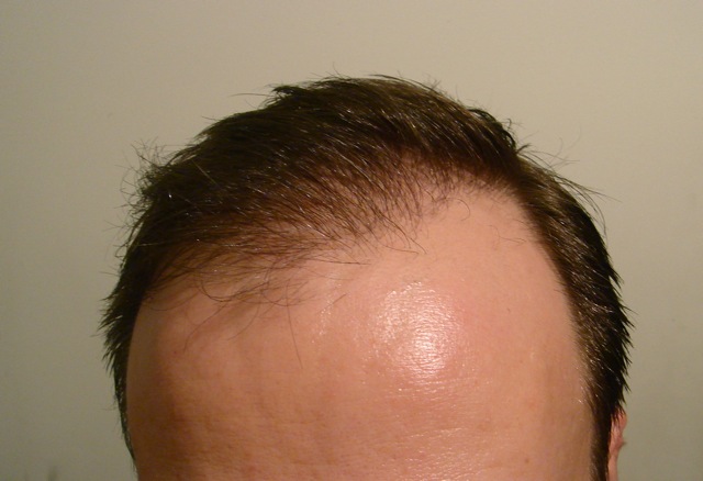 index.php/fa/2000/0/