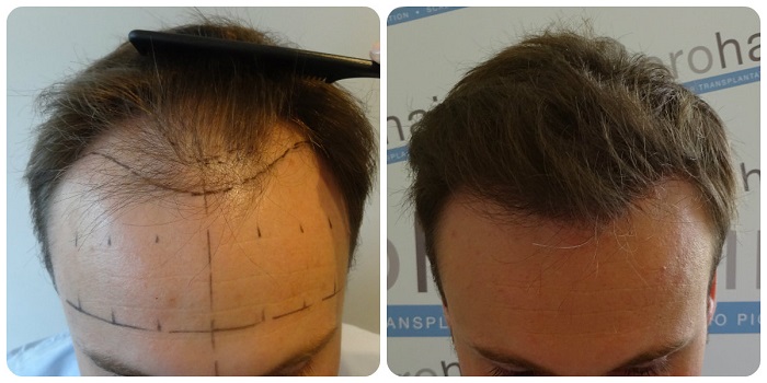 index.php/fa/20466/0/