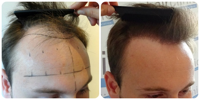 index.php/fa/20468/0/