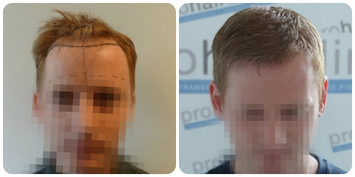 index.php/fa/20499/0/