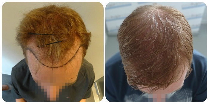 index.php/fa/20500/0/