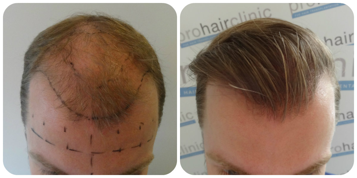 index.php/fa/20514/0/