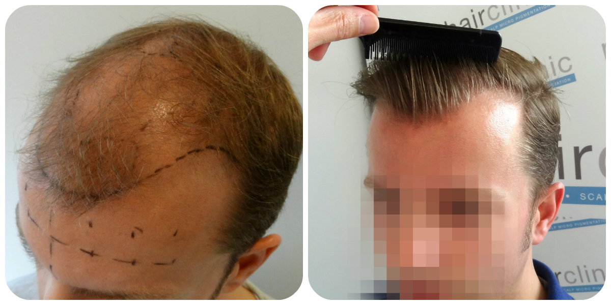 index.php/fa/20515/0/