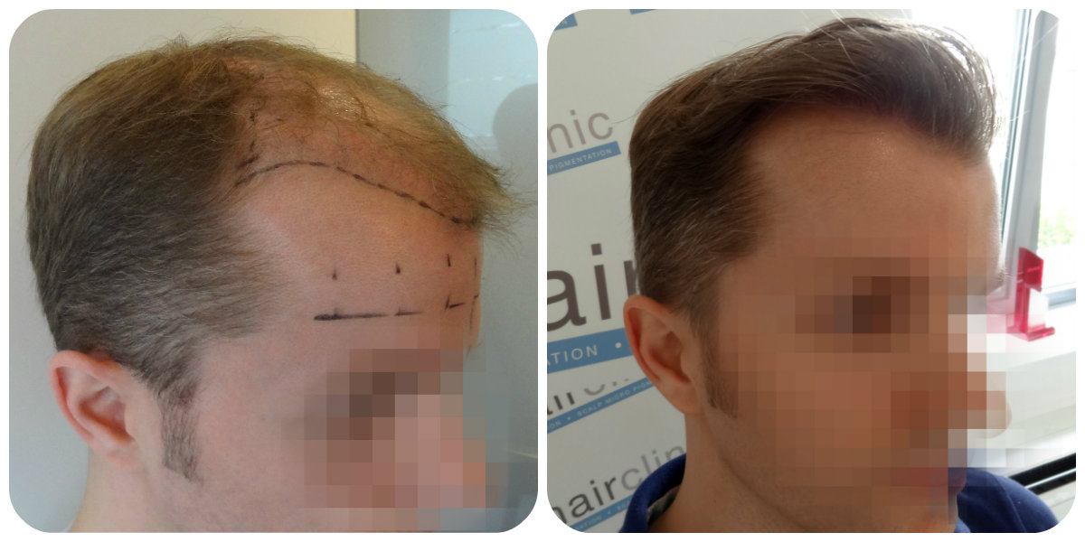 index.php/fa/20516/0/