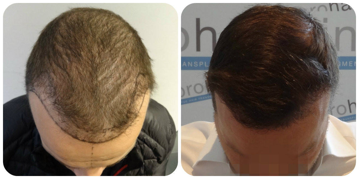 index.php/fa/20632/0/