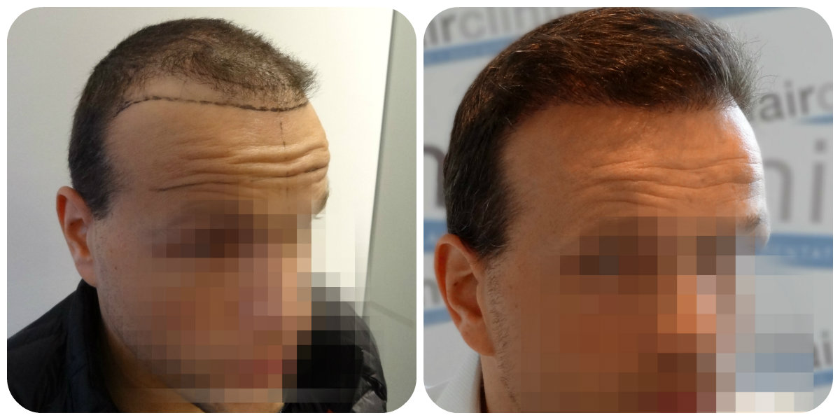 index.php/fa/20633/0/