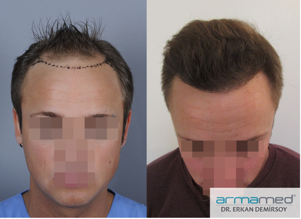 index.php/fa/21317/0/