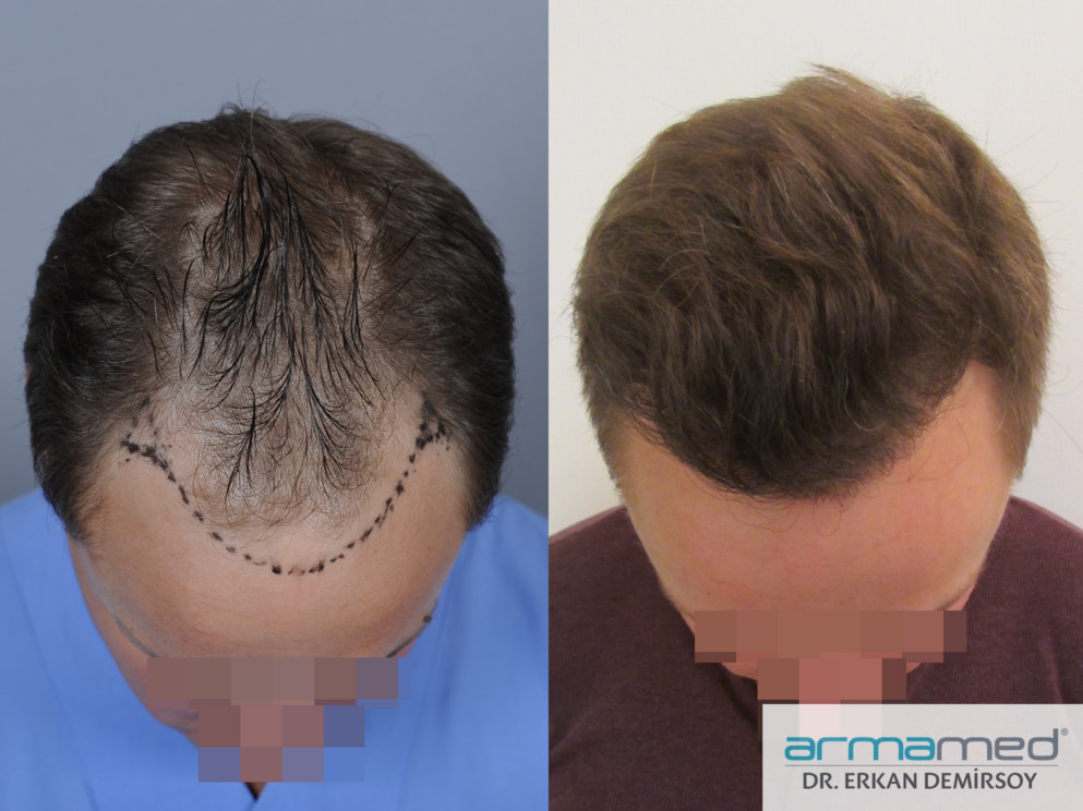 index.php/fa/21318/0/