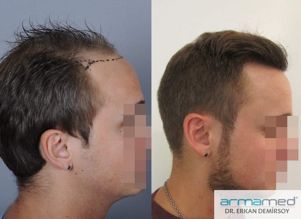 index.php/fa/21320/0/