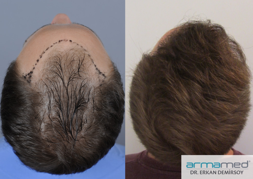 index.php/fa/21321/0/