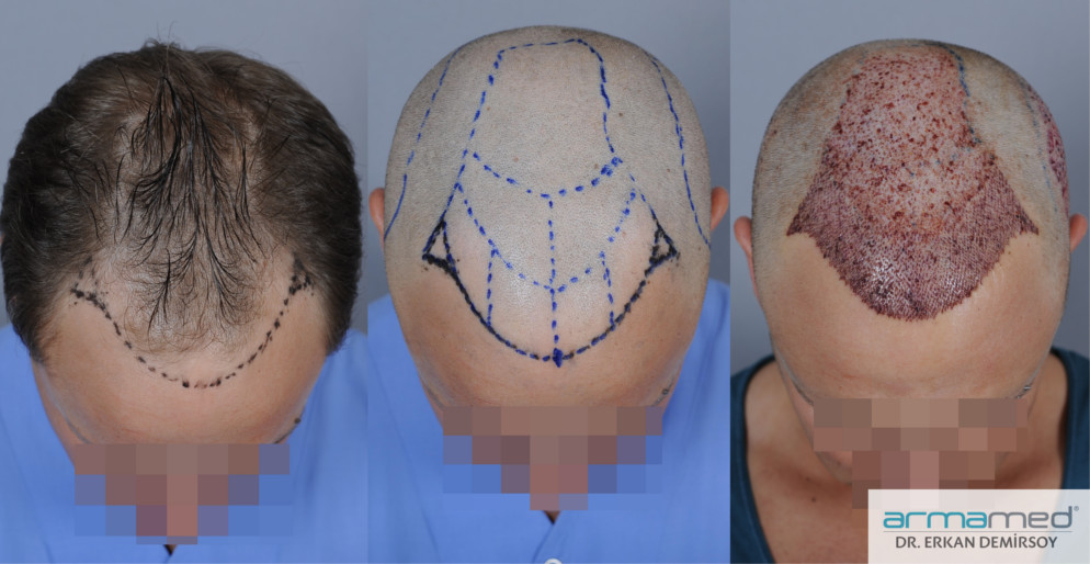 index.php/fa/21322/0/