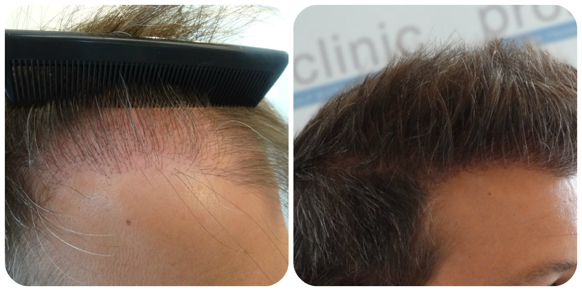 index.php/fa/21369/0/