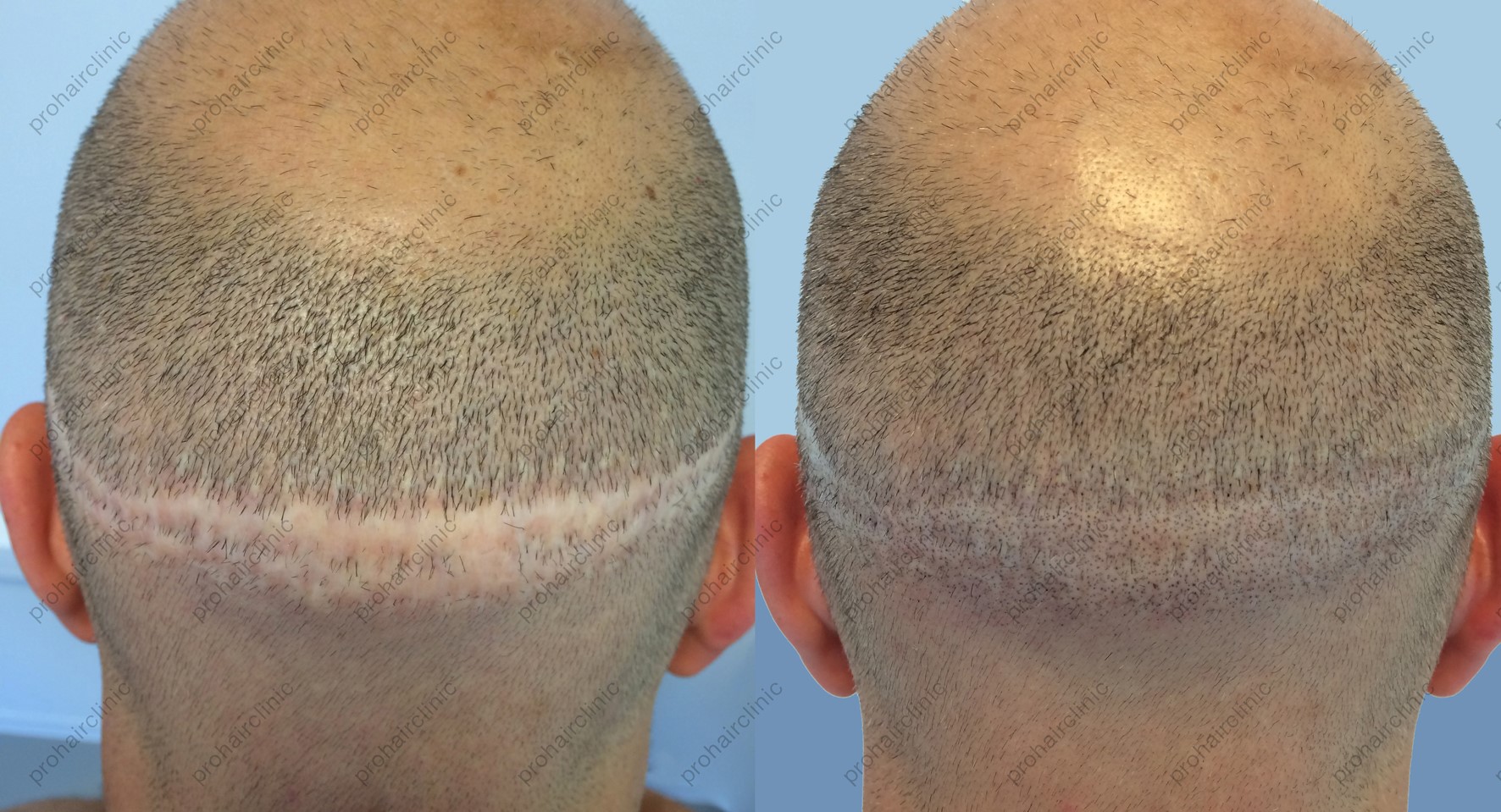 index.php/fa/21415/0/