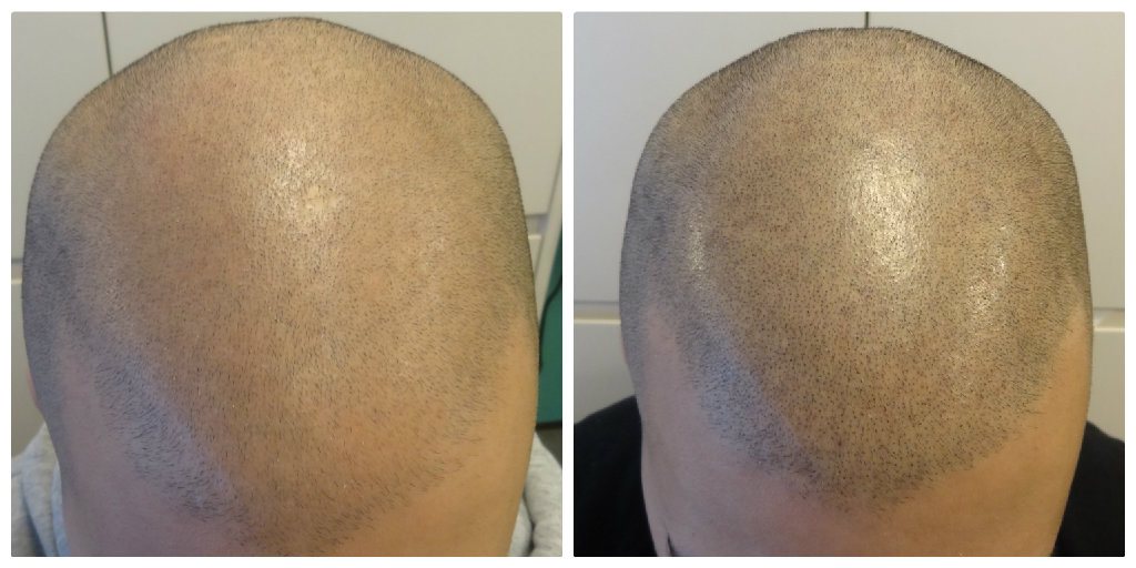 index.php/fa/21496/0/