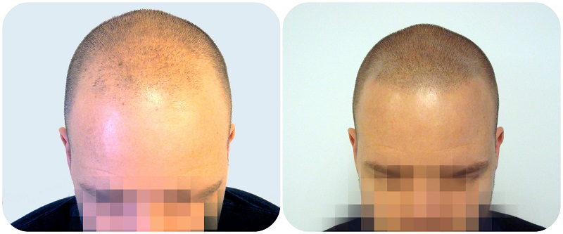 index.php/fa/21497/0/