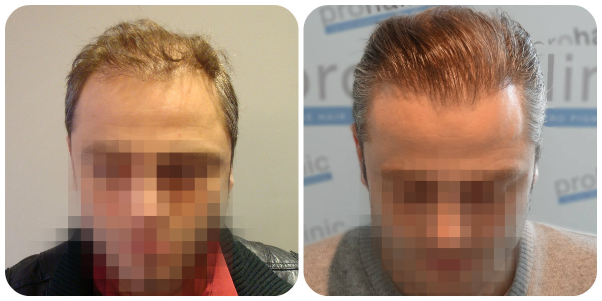 index.php/fa/21541/0/