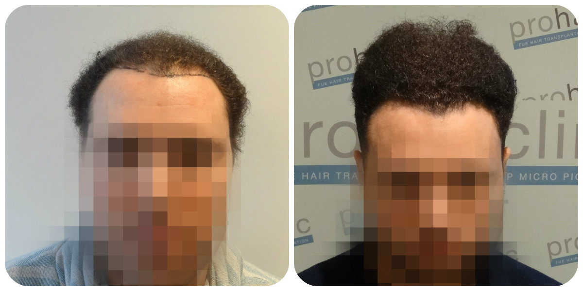 index.php/fa/21662/0/