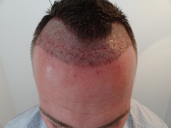 index.php/fa/21914/0/