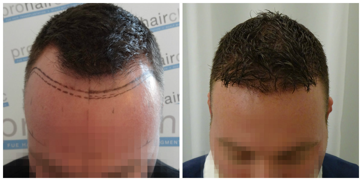 index.php/fa/21915/0/