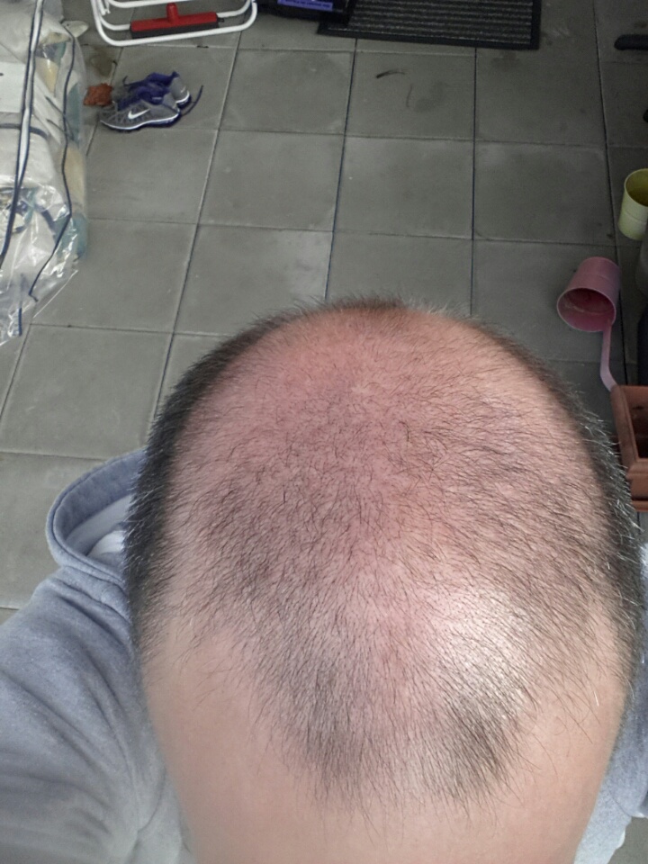 index.php/fa/21921/0/