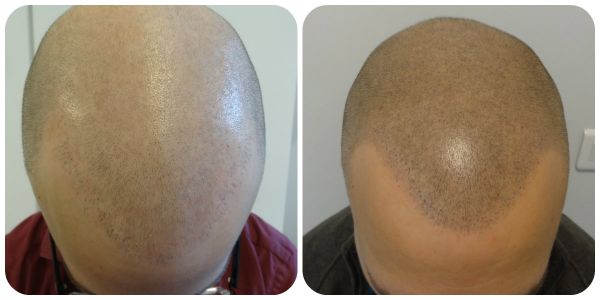 index.php/fa/21931/0/