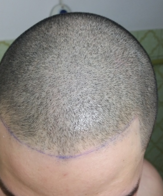 index.php/fa/22313/0/