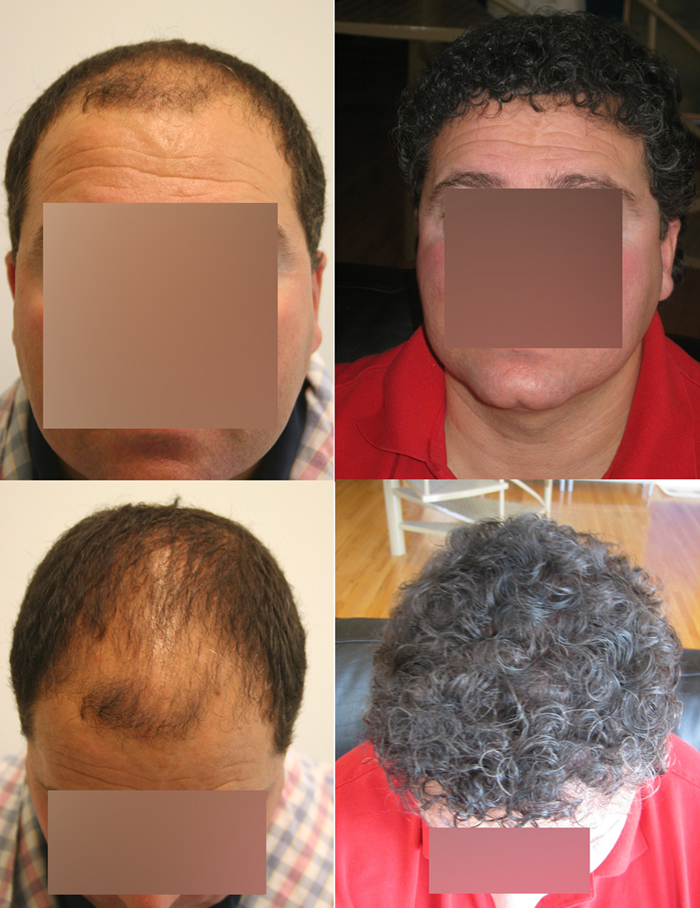 index.php/fa/2250/0/