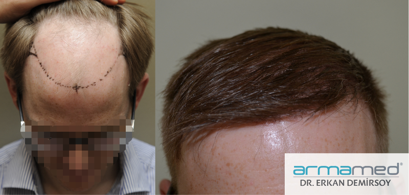 index.php/fa/22560/0/