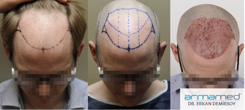 index.php/fa/22561/0/